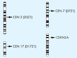 It describes a growth of abnormal but if you have any symptoms, it is important to get them checked by your gp. Bladder Cancer New Quadruple Color Fish Probe Clinisciences