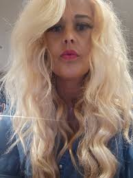 What are binders in dialysis?