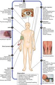 Diabetes, lupus and other diseases and fungal infections that disproportionately affect the elderly may cause hair loss. Diabetes Mellitus Basicmedical Key