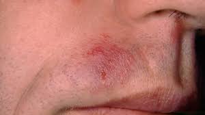 We did not find results for: Was Pilze Alles Im Gesicht Anrichten Springerlink