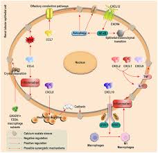 Image result for Calcium Nephrolithiasis