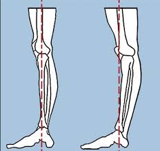 The knees are two of the most important joints in. Key To A Locked Knee