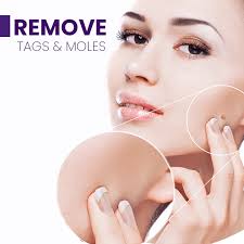 Sheva Spot retire pigmantasyon plim