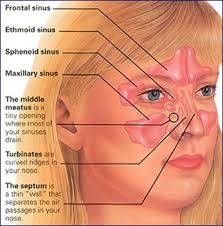 Liputan6.com, jakarta hidung tersumbat merupakan masalah bagi setiap orang. Ain Drsneez Stokis Selsema Punca Hidung Tersumbat Kesukaran Bernafas Akibat Hidung Tersumbat Antara Gangguan Paling Lazim Pada Kanak Kanak Dan Orang Dewasa Ia Bukan Saja Menyebabkan Ketidakselesaan Malah Pernafasan Menjadi