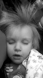 Little girl has hair that's impossible to tame thanks to her uncombable  hair syndrome