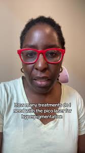 Nd Pico Yag Laser Ebay Reviews