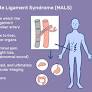 Median Arcuate Ligament Syndrome from www.verywellhealth.com