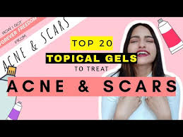 10 Tips To Lose Weight In Winters Part 1 Sardiyo Me Vajan Kaise Ghataye Youtube