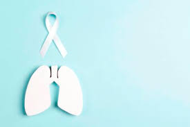 It is responsible for more deaths than breast, colon, and prostate cancers combined, according to the international. Lung Cancer Ribbon Stock Photos And Images 123rf