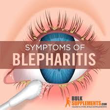 Image result for Blepharis bainesii