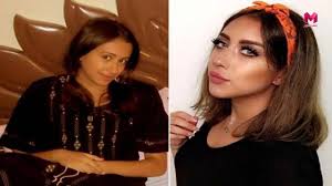 ما سويت شي بس تقويم أسنان وأبر. Ø¹Ù‚ÙŠÙ„ Ø§Ù„Ø±Ø¦ÙŠØ³ÙŠ