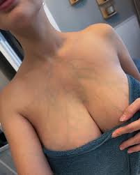 Veins are beautiful. Thats a preggo perk 😜