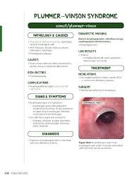 The iron deficiency is typically chronic and severe. Plummer Vinson Syndrome Foundations Osmosis