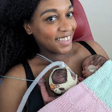 Has anyone's little one been born at 28 weeks and had an opp at birth?