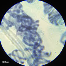 Paramecium under microscope 400x labeled. Spirogyra Green Algae Under The Microscope