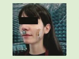 Chipless RF Identification Sensors for Vital Signs Monitoring