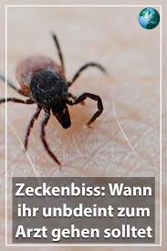 Zeckenbiss Wann Sie Zum Arzt Mussen Zeckenbiss Zecke Arzt