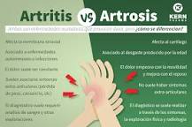 Resultado de imagen para diferencia entre artritis y artrosis