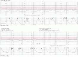 exercises in electronic fetal monitoring obgyn key