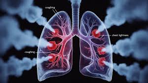 Image result for Pulmonary Intoxicant