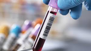 Hba1c Wert So Berechnet Man Den Langzeitzuckerwert Tabelle Onmeda De