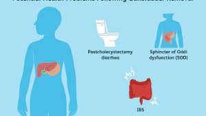 Maybe you would like to learn more about one of these? Gallbladder Removal What To Eat For Better Management