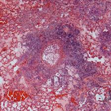 Aspergillus fumigatus is almost always the species responsible. Geisel School Of Medicine At Dartmouth Obar Laboratory Pulmonary Immune Response To I Aspergillus Fumigatus I