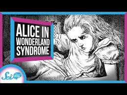 Alice In Wonderland Syndrome Youtube Alice In Wonderland Syndrome Alice In Wonderland Wonderland
