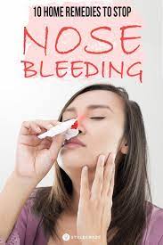 10 Effective Home Remedies To Stop Nose Bleeding Stop Nose Bleeds Nose Bleeding Dry Nose Remedy
