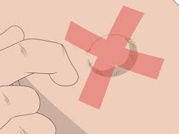 You can also use hot compresses between baths. 3 Ways To Drain A Cyst Wikihow