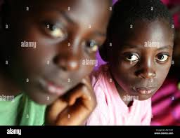 Hiv children hi-res stock photography and images