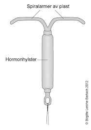 Celleprøve, prevensjon og testing av kjønnssykdommer. Hormonspiral Nhi No