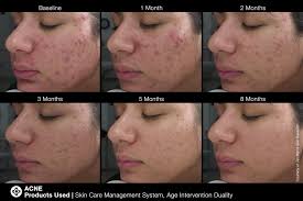 Official jan marini skin research facebook page. Skin Care Management System Jan Marini Australia
