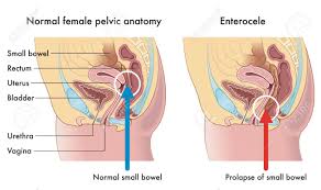 The video is narrated by one of our awesome anatomists. Medical Illustration Shows The Female Pelvic Anatomy One With Royalty Free Cliparts Vectors And Stock Illustration Image 151774867