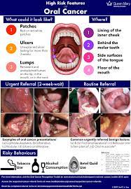 Therefore, it is beneficial for an individual to. Pdf High Risk Features Of Oral Cancer