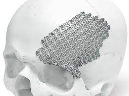 Looking for a good deal on mesh titanium? Uses Of Titanium Mesh North Steel Co