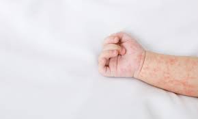 Several clues can indicate that a cut is infected or at increased risk of infection. Does This Look Infected How To Tell If You Have An Infection Cityhealth