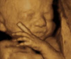 Apr 06, 2021 · how big is your baby at 26 weeks? You Are 26 Weeks And 5 Days Pregnant Familyeducation