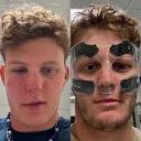 Milb Central on X: "Brock Wilken was hit in the face by a pitch on ...