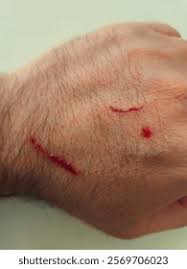 Image result for Combustio