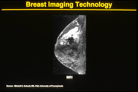 If you have a condition like cancer , heart disease , emphysema , or liver masses, ct scans can spot it or help. Breast Mri Wikipedia