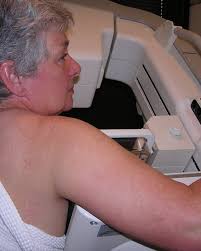 More women getting both breasts removed when cancer strikes one