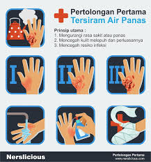 Jangan menggunakan es, air es, atau bahan berminyak. Pertolongan Pertama Tersiram Air Panas Nerslicious