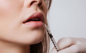 На думку українських лікарів, під час лікування хворих на коронавірус на їхню думку, швл можуть представляти пряму і безпосередню загрозу життю і здоров'ю певної категорії хворих. Injections D Acide Hyaluronique Dans Les Levres Dr Benouaiche Paris