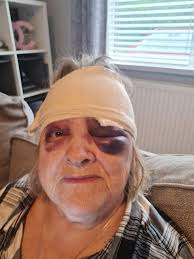 A huge thank you to the gentleman from Abbey Motors in Old Cwmbran (  opposite Broadweir Road ) for helping my mum Maggie Berry when she fell  yesterday. She's pretty bruised 🙈