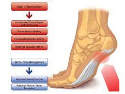 High Level Laser Therapy For Arthritis And Foot Pain Eltham Foot Clinic