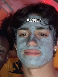 Marco Phillips Eyeshape