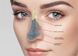 You May Be Satisfied With The Appearance Of The Nose If It Was Good In Other Areas And So O Nose Job Cost Rhinoplasty Nose Plastic Surgery Rhinoplasty Surgery