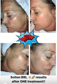 D-Lux Medspa, 6100 Trail Blvd, Ste 205, Naples, FL 34108, US