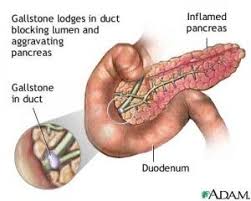 Pin On Pathophysiology